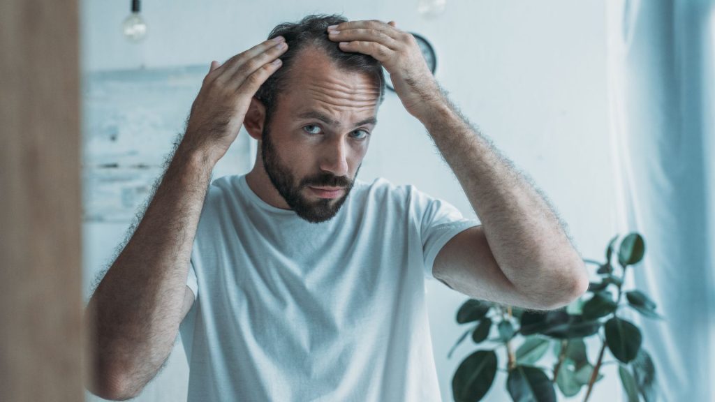 Why Choose Stem Cell Therapy for Hair Loss in Mexico