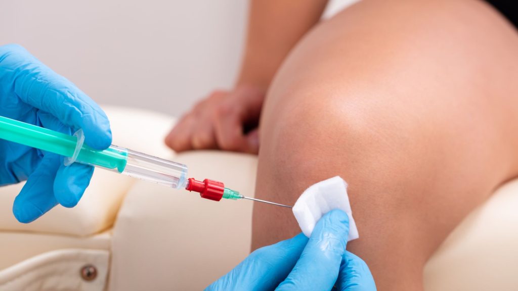 Expected Recovery After Stem Cell Knee Injections