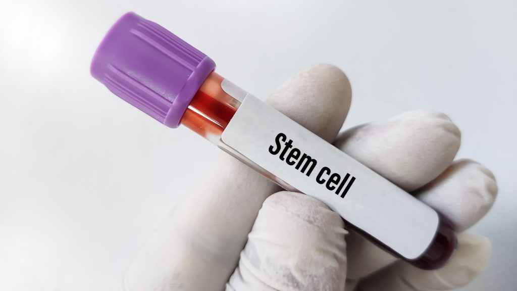Understanding Medicare Coverage for Stem Cell Therapy