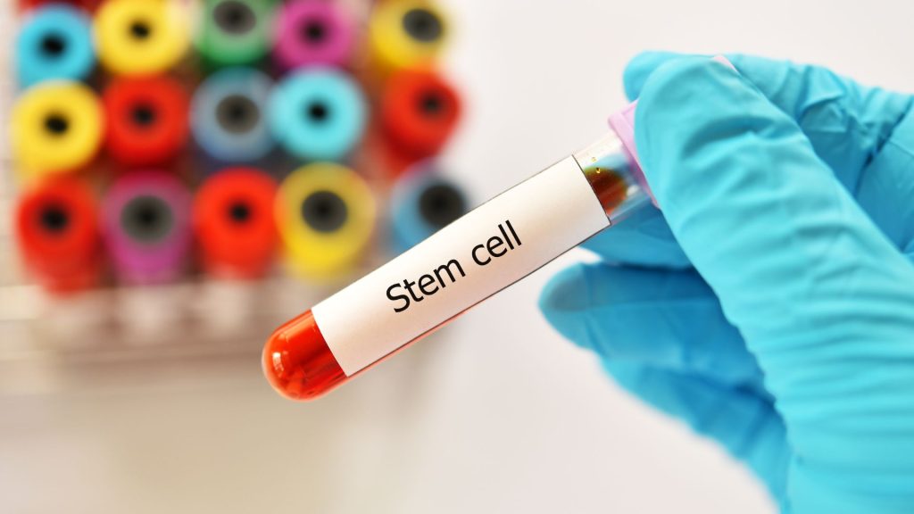 Understanding Stem Cell Therapy for Knee Pain