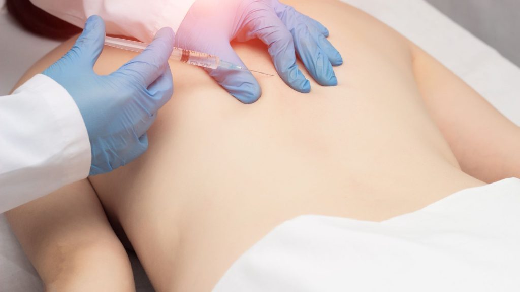 Non-Surgical Back Pain Treatments vs. Stem Cell Therapy