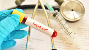 Stem Cell Therpy for knees