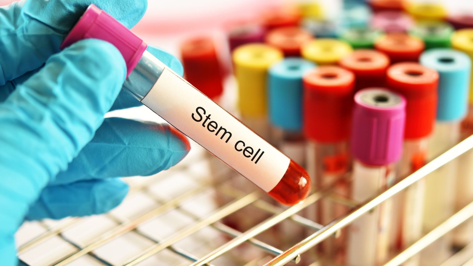 stem cell therapy Mexico